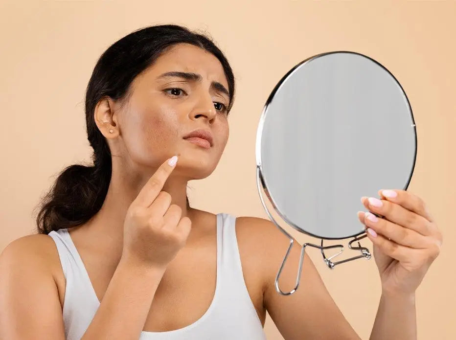 Dry Skin Acne