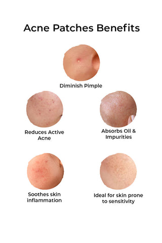 Acne pimple patches